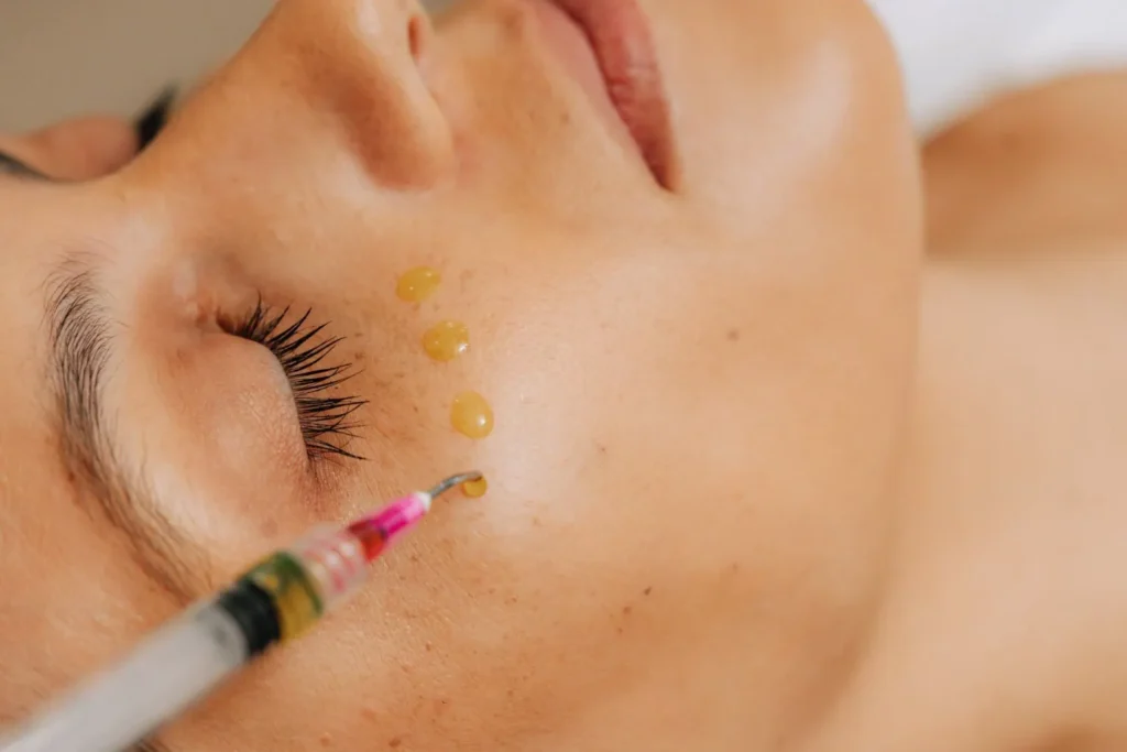woman receiving a chemical peel