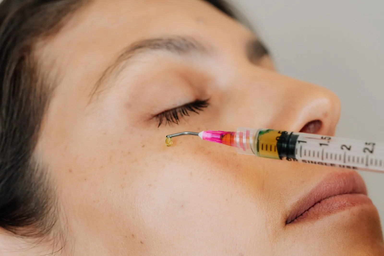 client receiving a chemical peel treatment