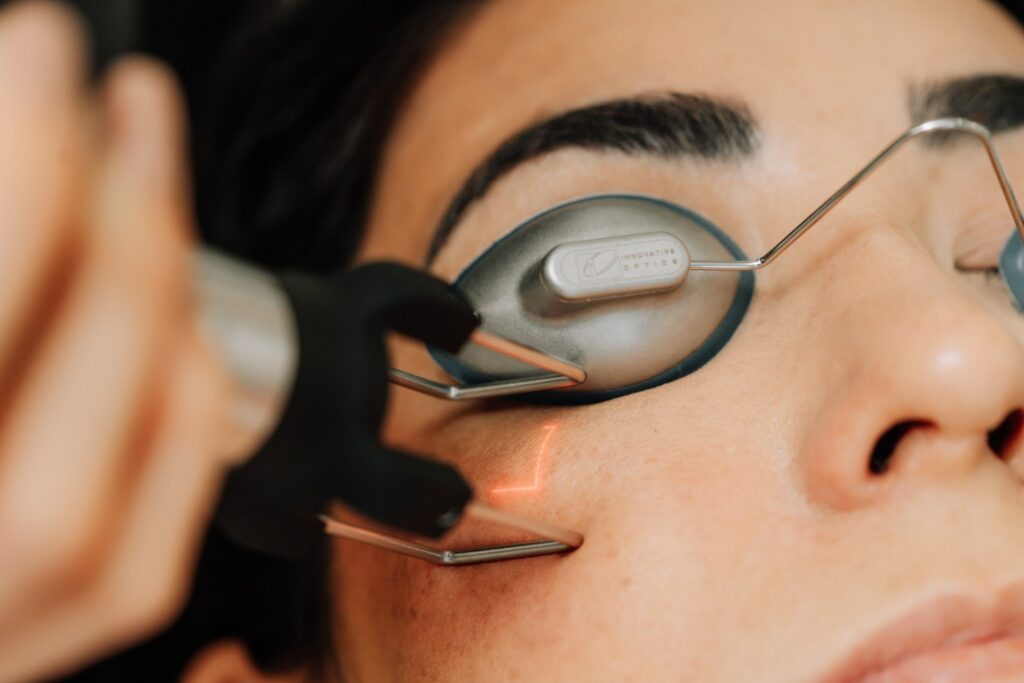 A person receiving the CoolPeel laser resurfacing treatment.