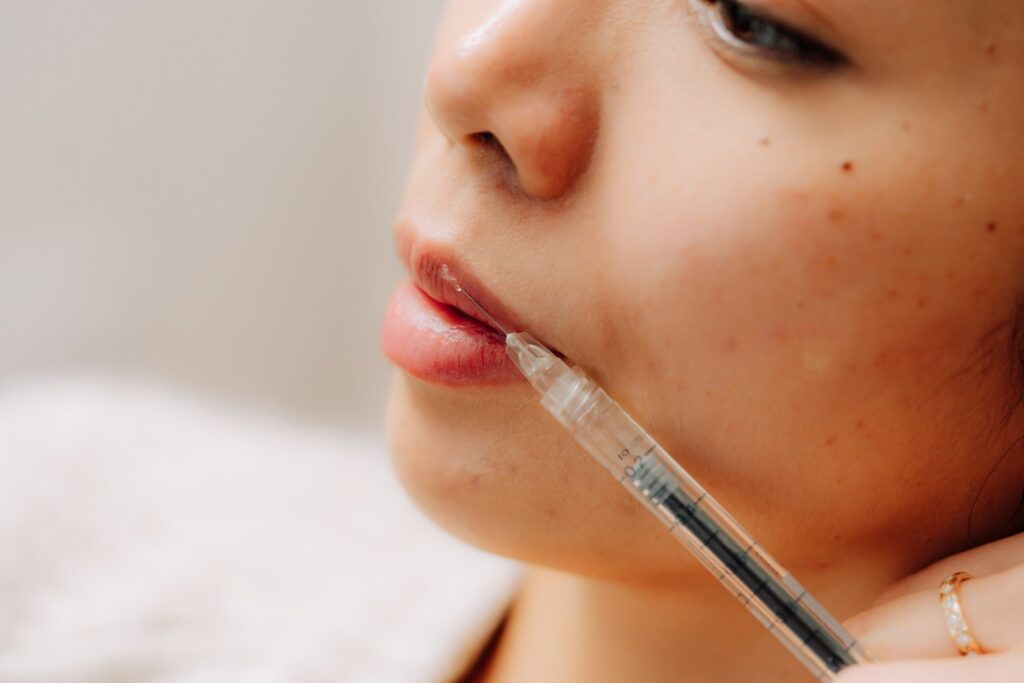 Women receiving lip fillers to her lips