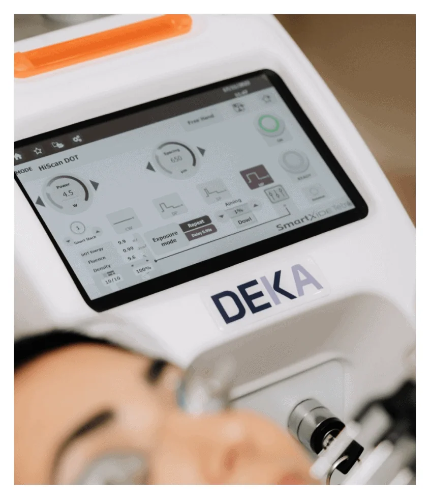 Screen of the DEKA CO2 laser