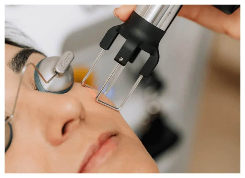 closeup of client receiving DEKA CO2 laser treatment