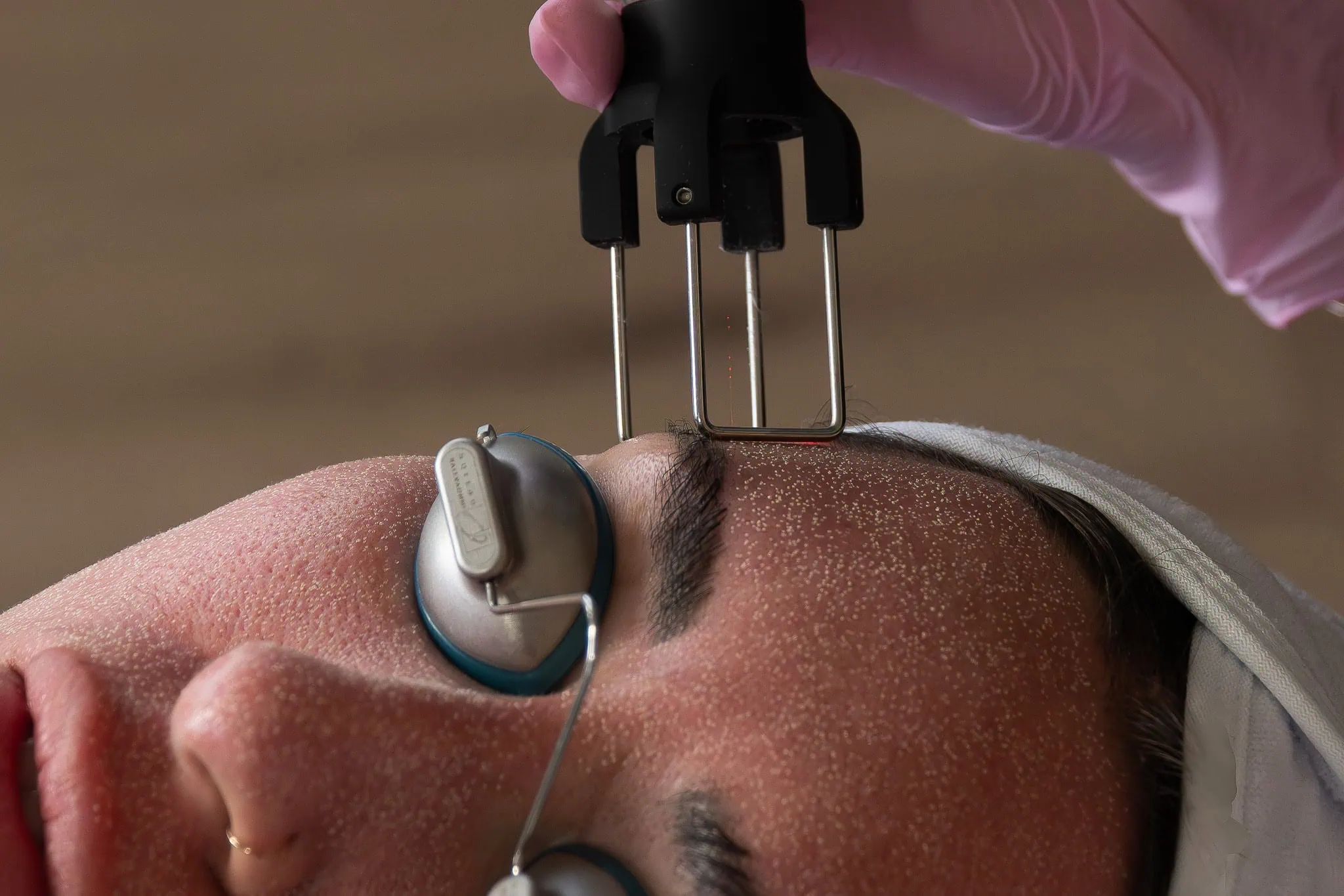closeup of client receiving laser skin treatment