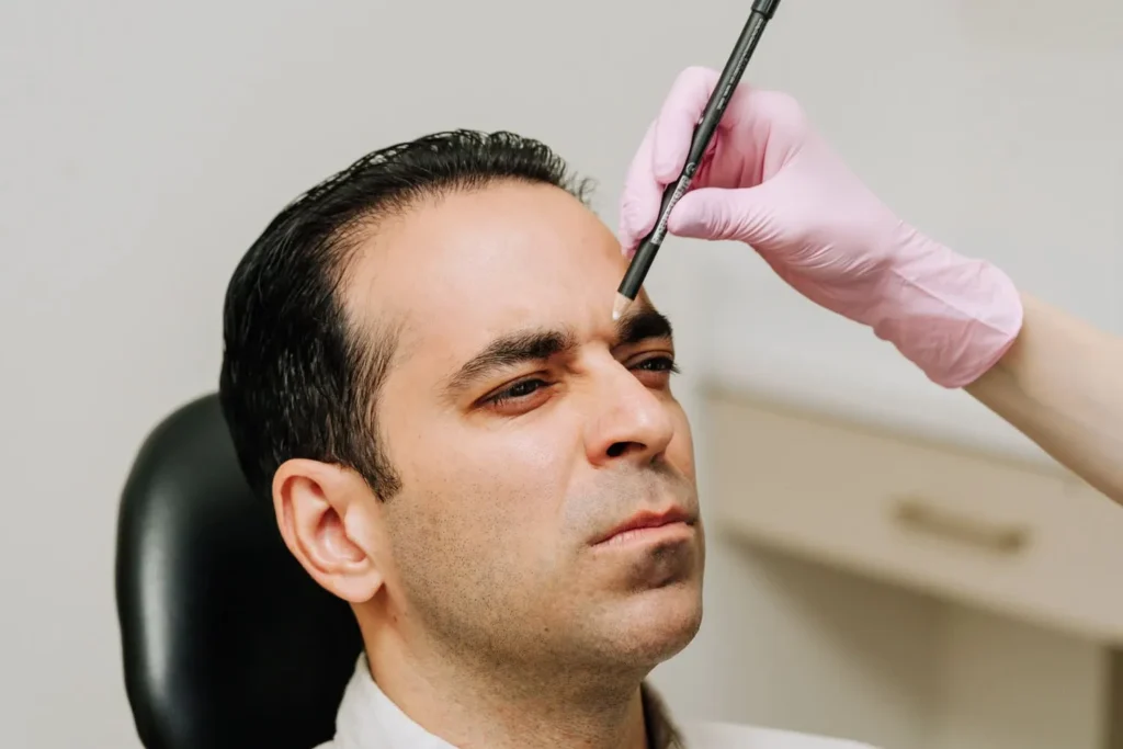 client face getting marked for Daxxify injections