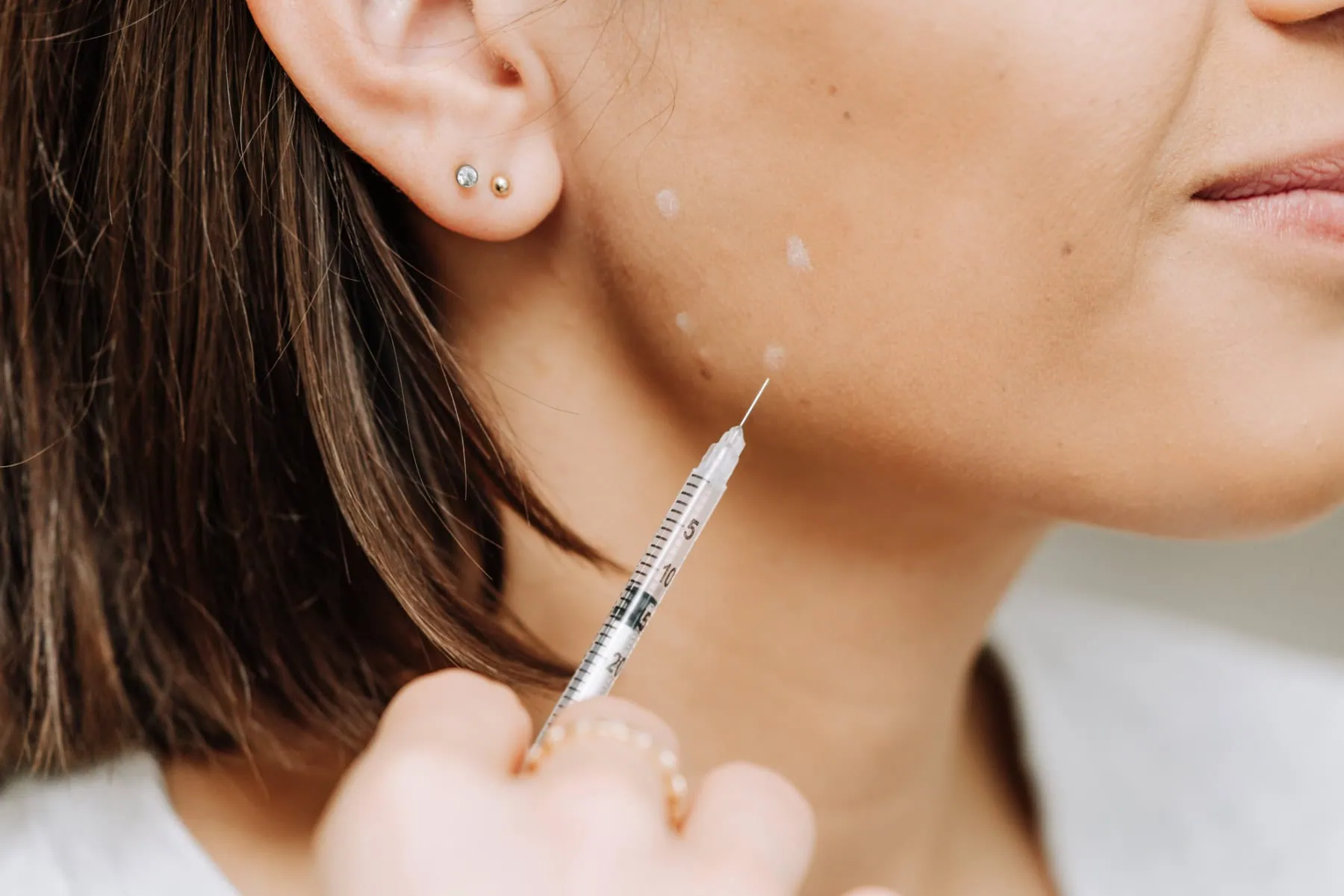 closeup of woman receiving masseter botox at our Scottsdale medispa