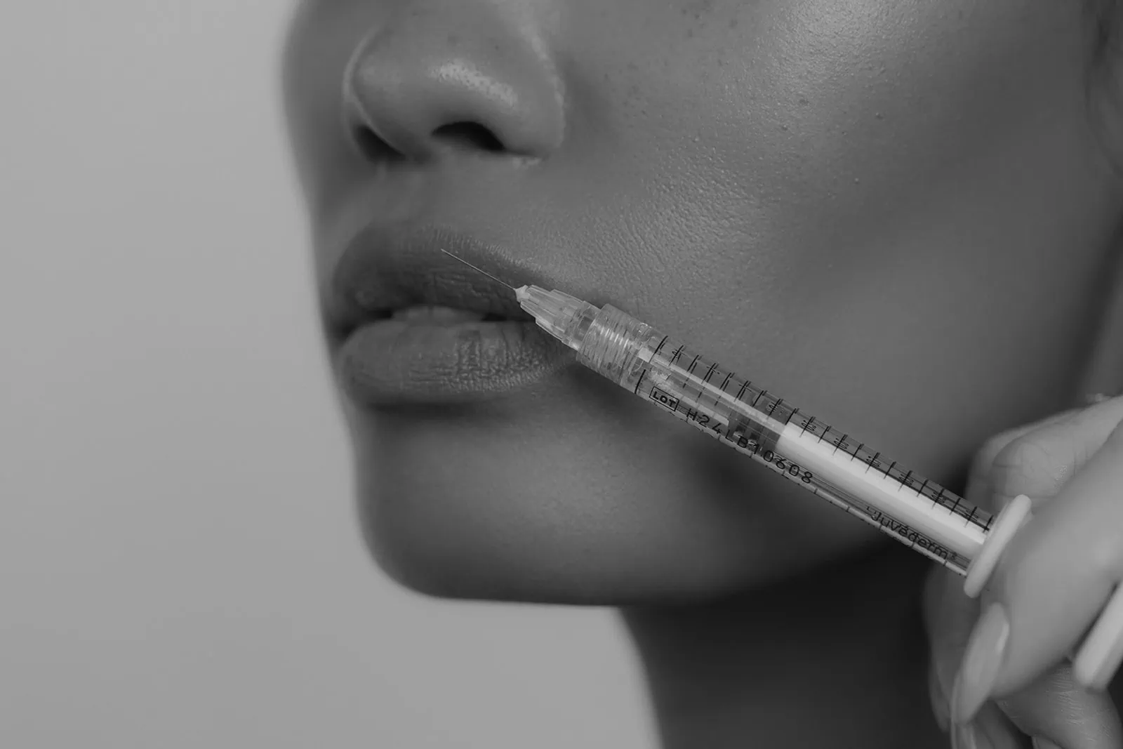 closeup of person receiving lip filler