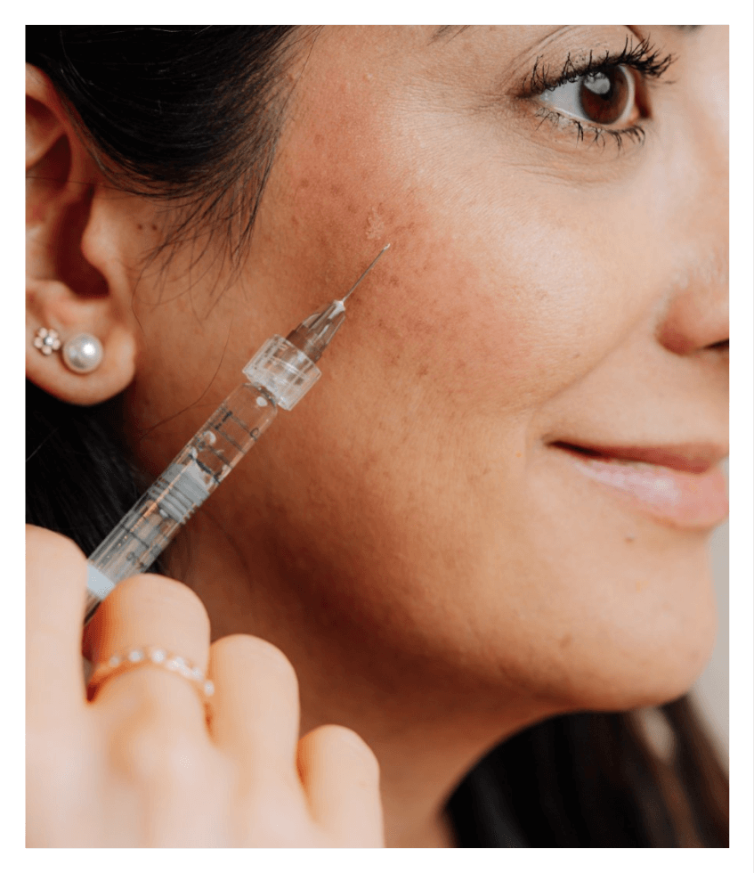 A woman with brown hair receiving Juvederm treatment on her cheek.