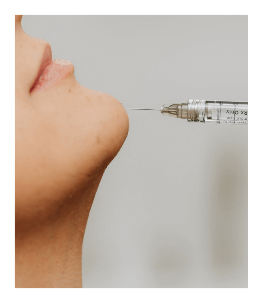A woman who is about to receive a Juvederm injection on her chin.
