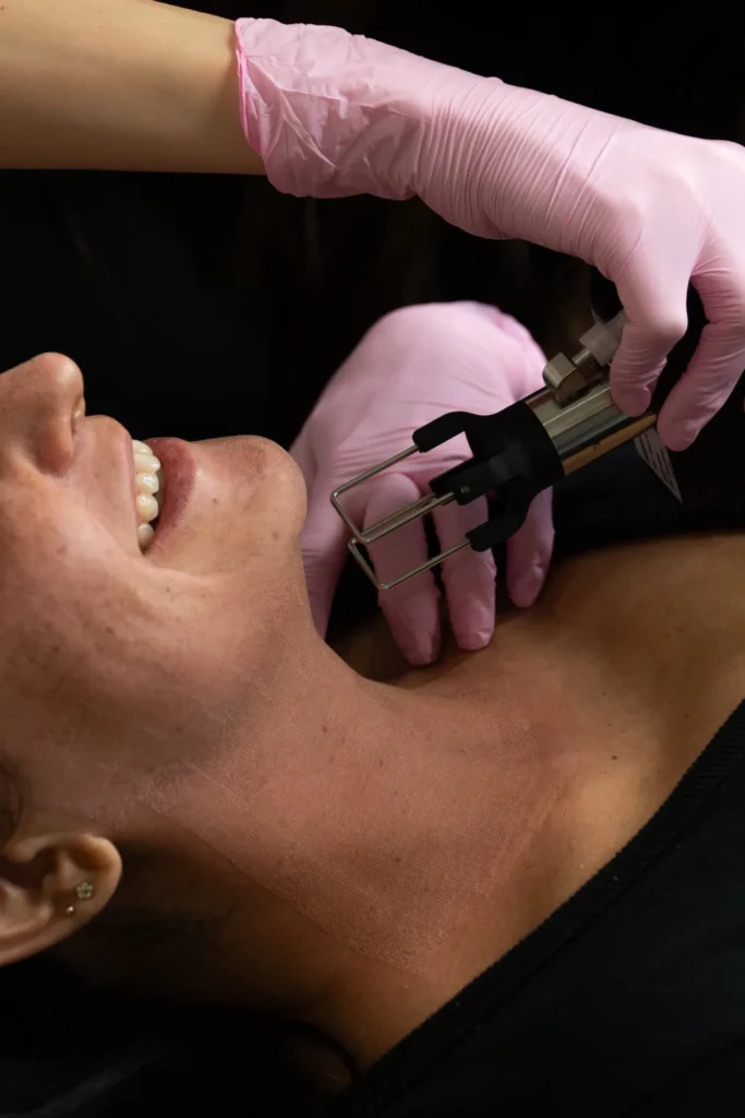 women receiving coolpeel laster treatment on her neck