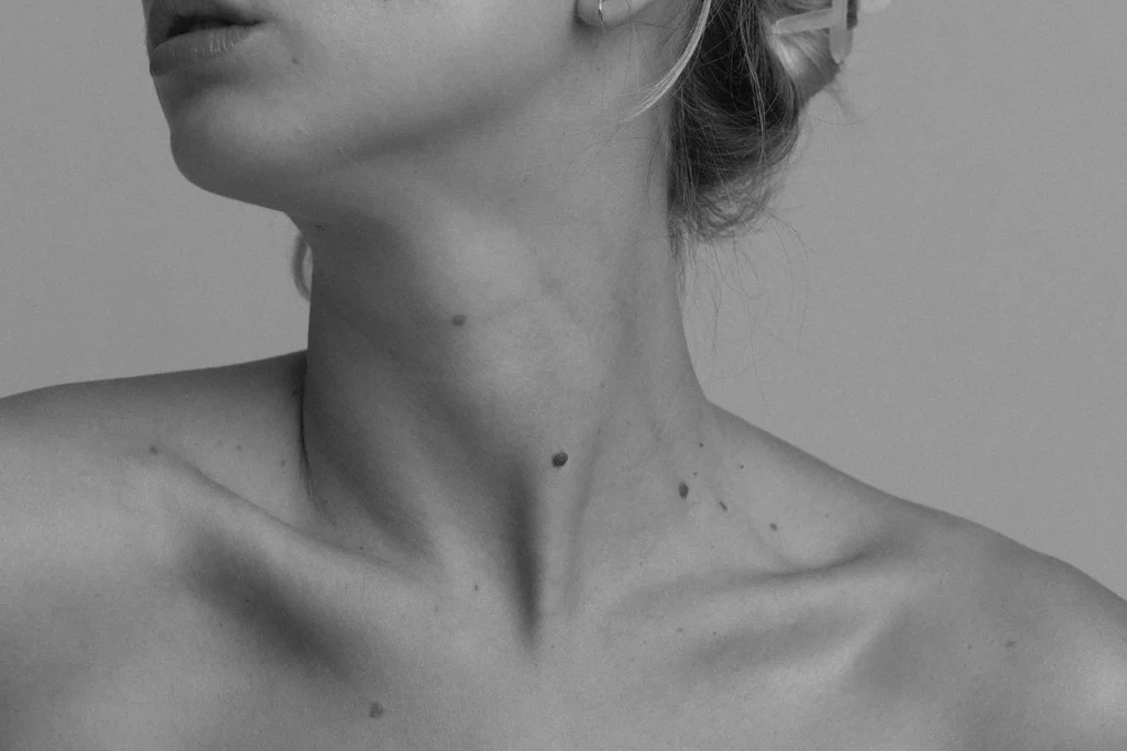 Black and white closeup of a woman’s neck showing early signs of aging and skin texture changes on the neck and décolletage.