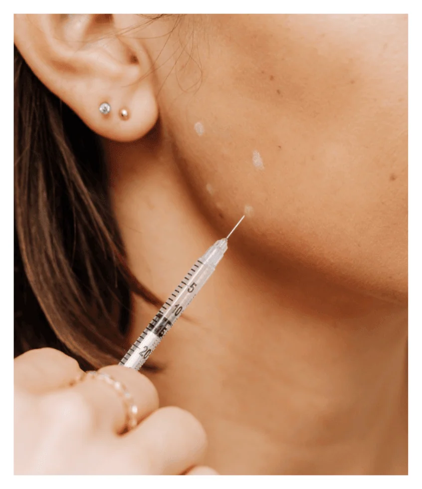close-up of a botox injection in the jaw area