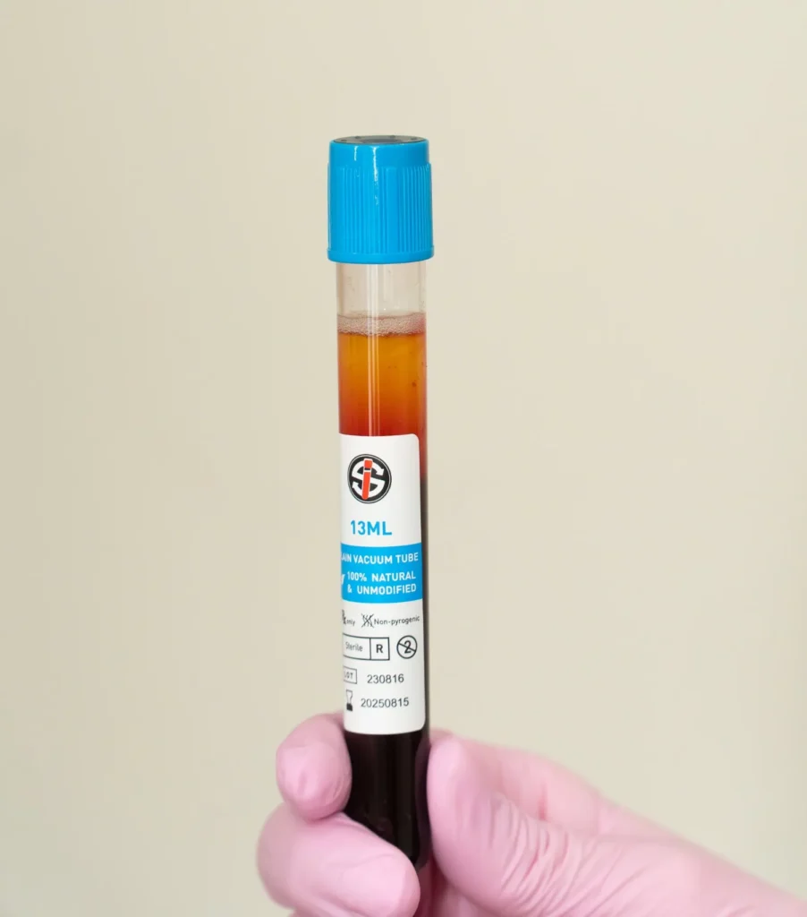 PRF tube prepared for under-eye rejuvenation treatment