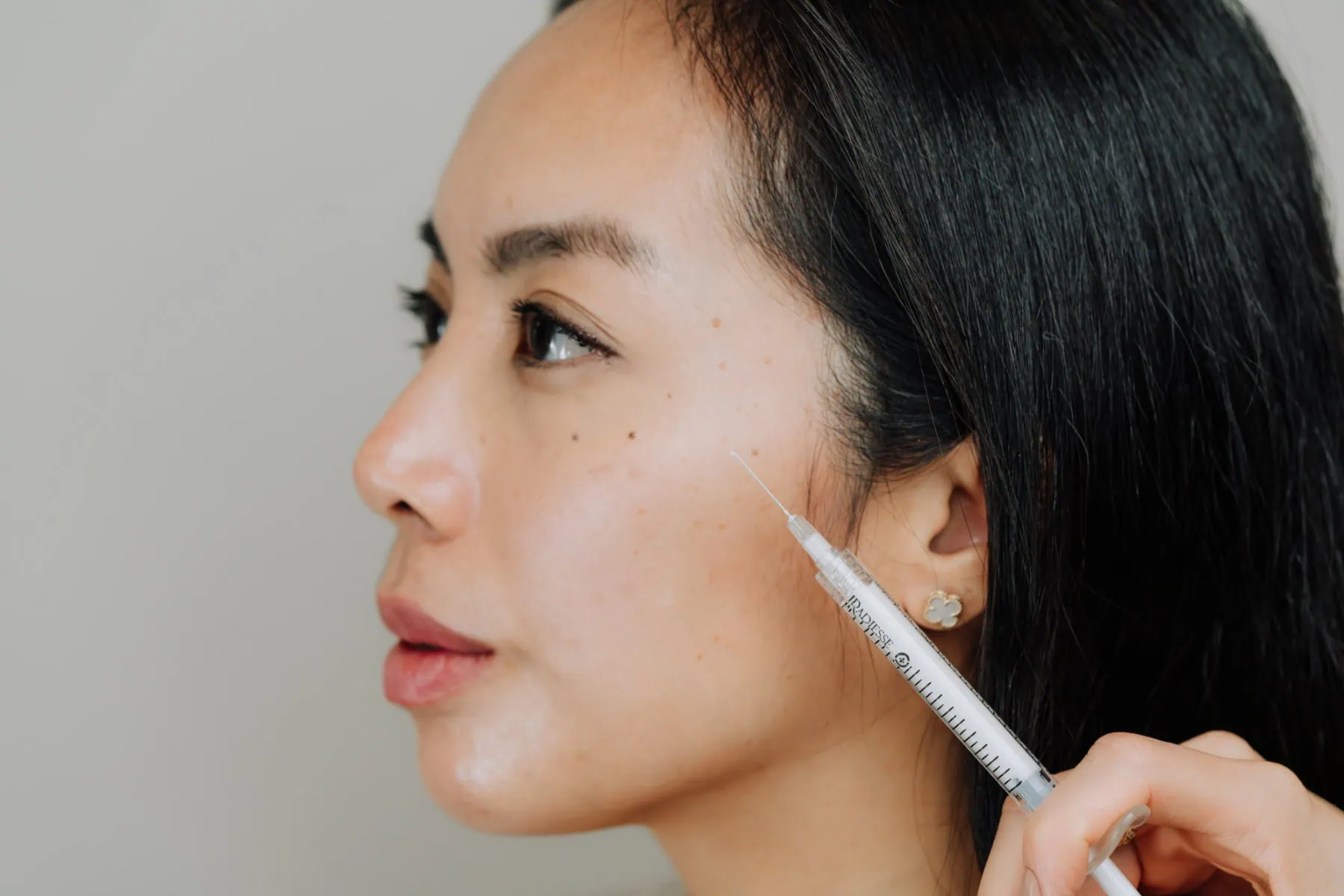 client receiving cheek filler at Curated Medical in Scottsdale