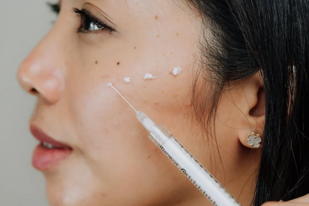 close-up of client receiving cheek filler in Scottsdale