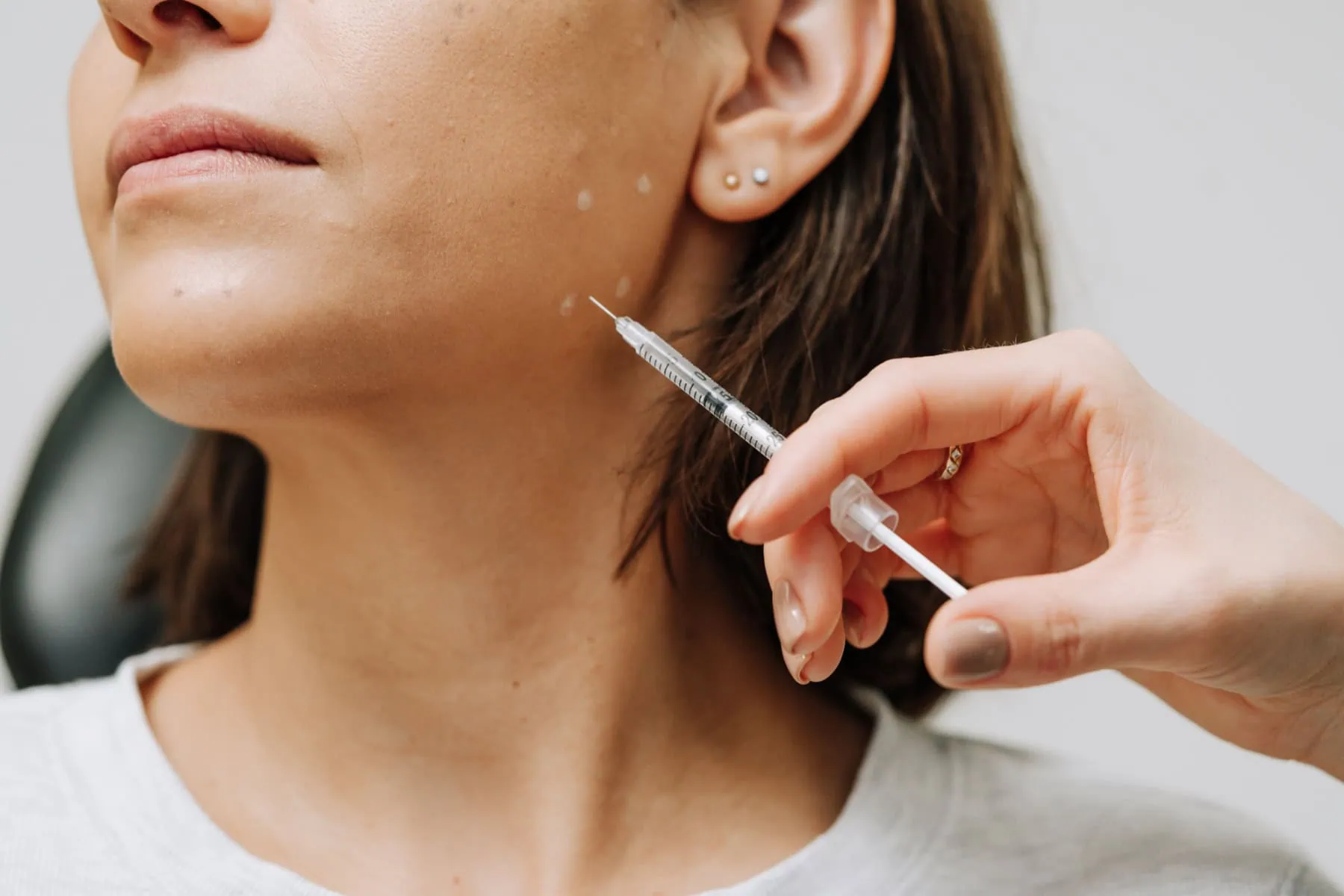 close-up of a woman receiving a botox injection in the lower face at Curated Medical in Scottsdale