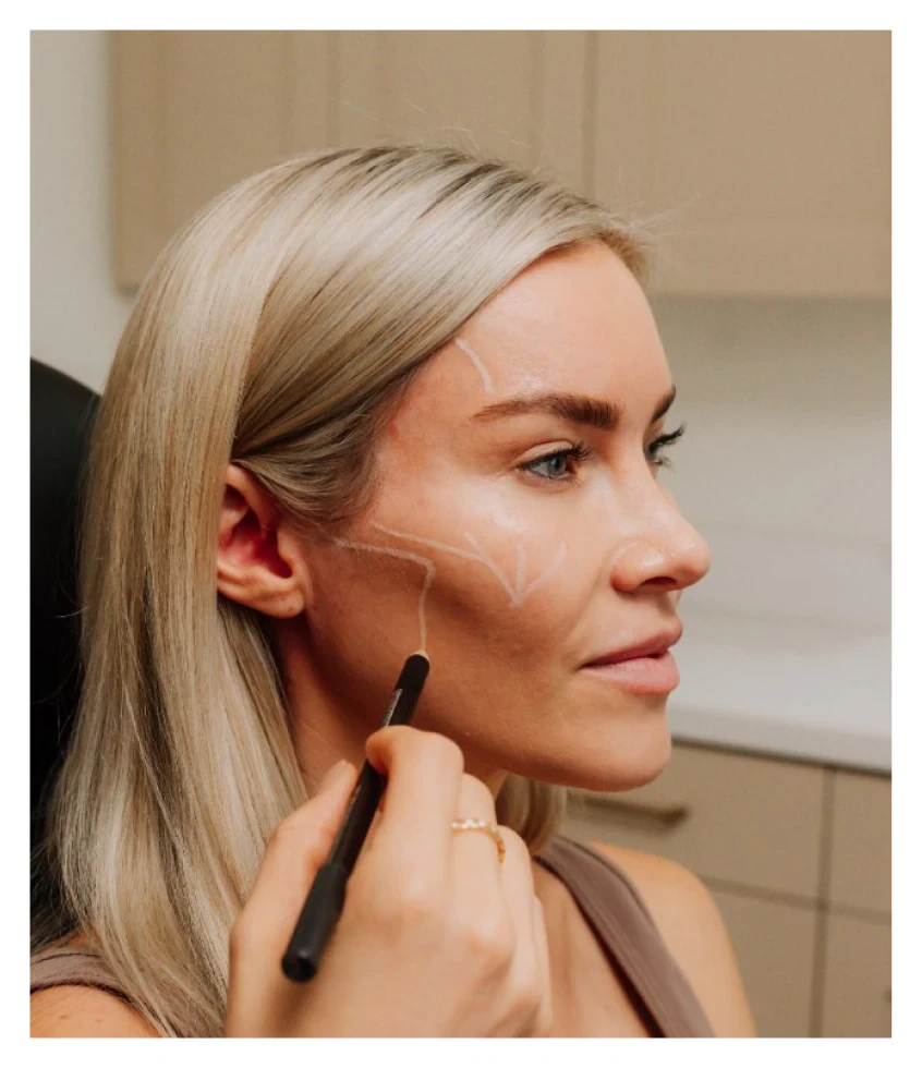 close-up of a woman receiving a sculptra injection in her right cheeck at Curated Medical in Scottsdale