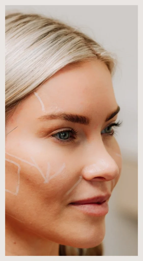 white markings on a woman's skin as preparation for her sculptra treatment at Curated Medical in Scottsdale